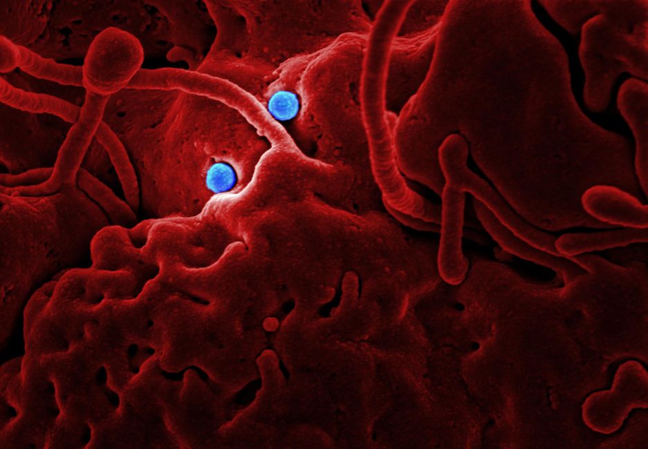 What Is Lymphocytes in a Blood Test? How to Read Your Immune System's  - immune system cells
