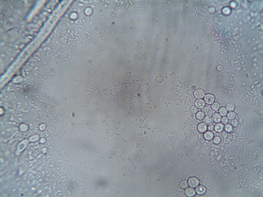 What Is ANC in a Blood Test? The Number That Decides Your Infection Ri - immune system cells
