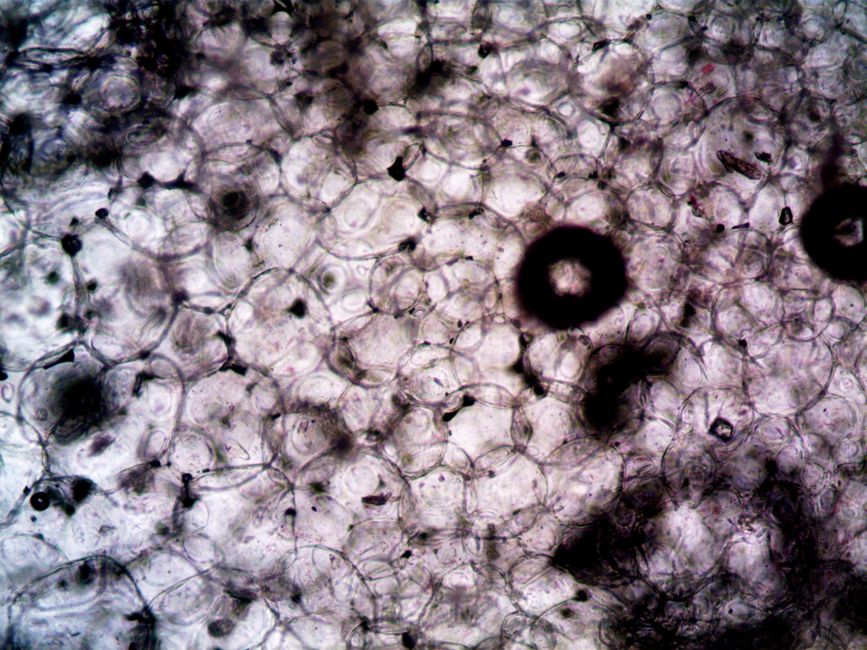 What Is WBC in a Blood Test? Your White Blood Cell Count, Decoded - immune system cells