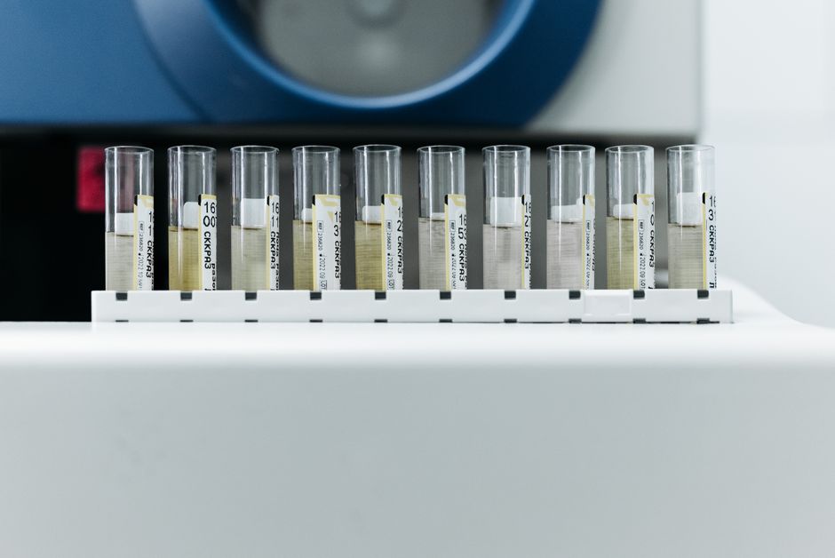 What Does a Low PLT Mean in a Blood Test? Low Platelet Count Explained - laboratory analysis