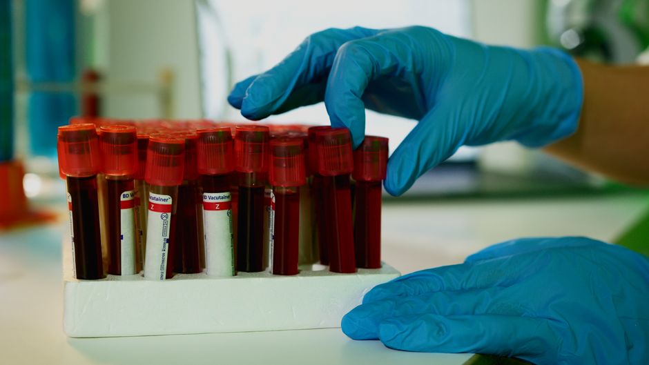 What Is a CMP Blood Test? The 14-Point Metabolism Check You Have Never - laboratory technician testing