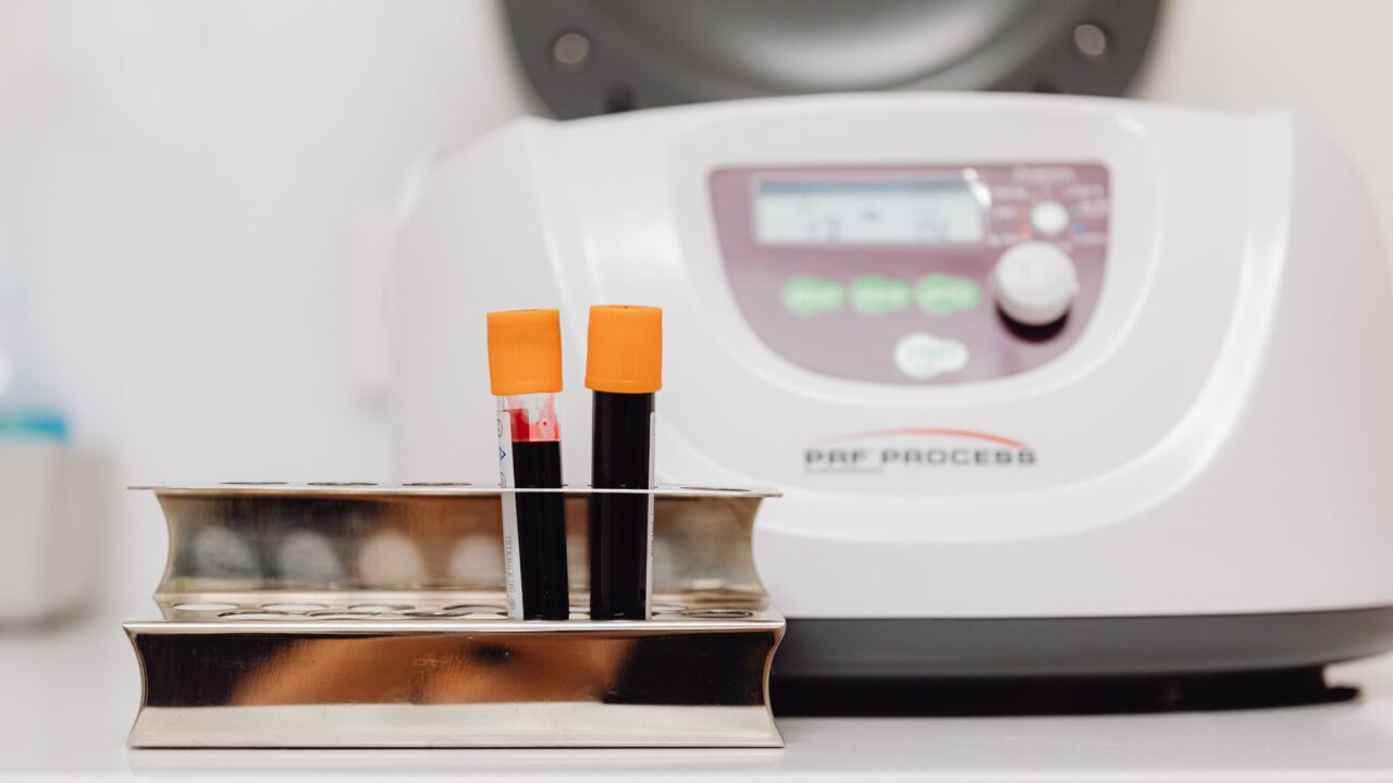 Low MPV Blood Test: What a Low Mean Platelet Volume Really Means