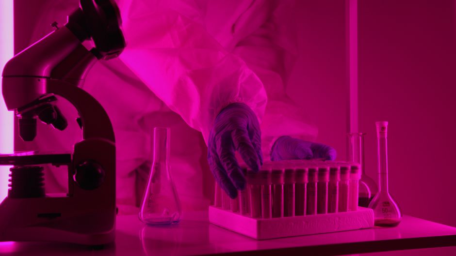 What Does High Potassium Mean in a Blood Test? Causes & Danger Levels - medical laboratory technician