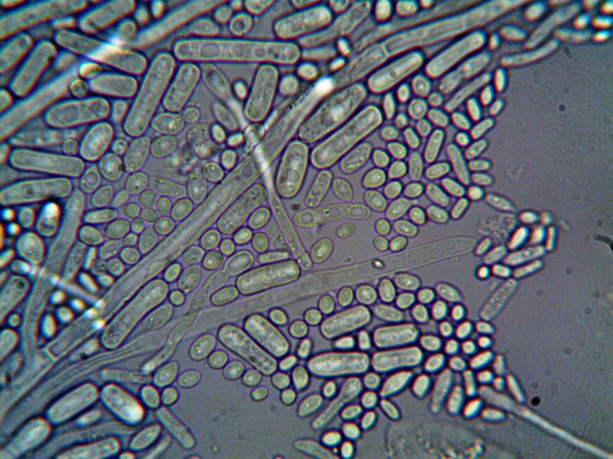 What Is HGB in a Blood Test? How to Read the Most Important Number on  - red blood cells microscope