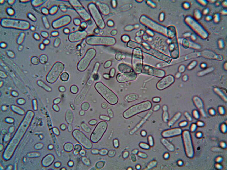 What Is RDW in a Blood Test? The Underrated Number That Predicts More - red blood cells microscope