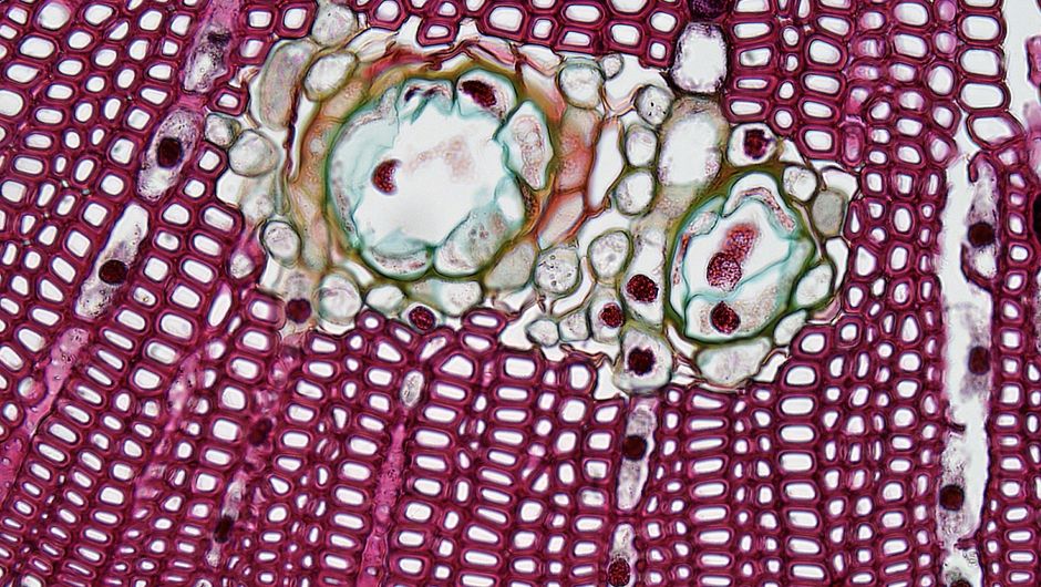 What Is a Low MCV in a Blood Test? Causes and What to Do - red blood cells microscope