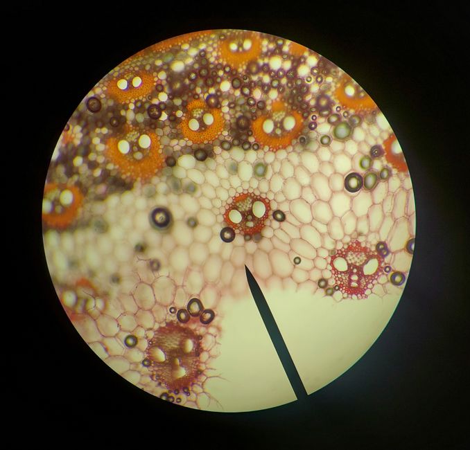 What Does Low Hemoglobin Mean in a Blood Test? Causes, Symptoms, and W - red blood cells microscope