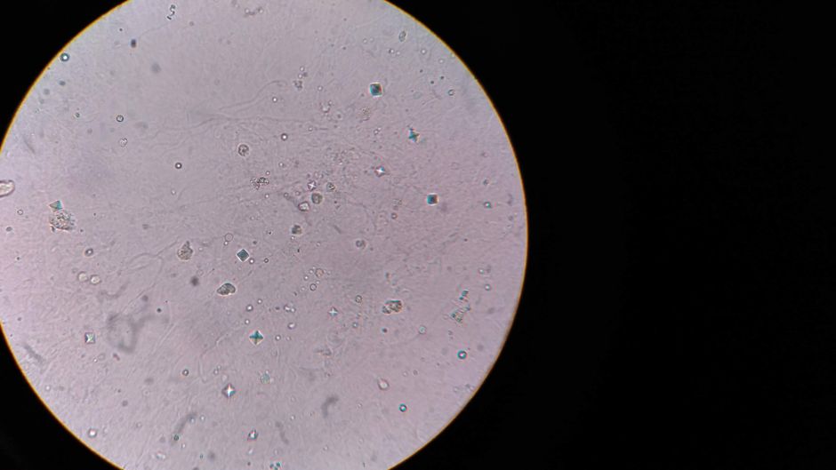 What Is a High RBC Blood Test? What an Elevated Red Blood Cell Count M - red blood cells microscope
