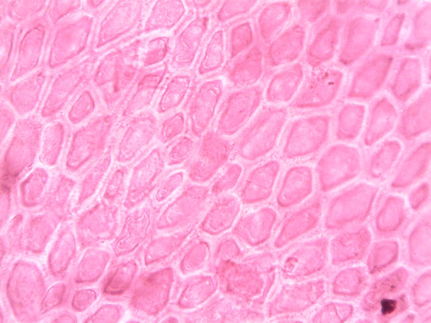 Low MCH on a Blood Test: What It Means and What to Do Next - red blood cells microscope