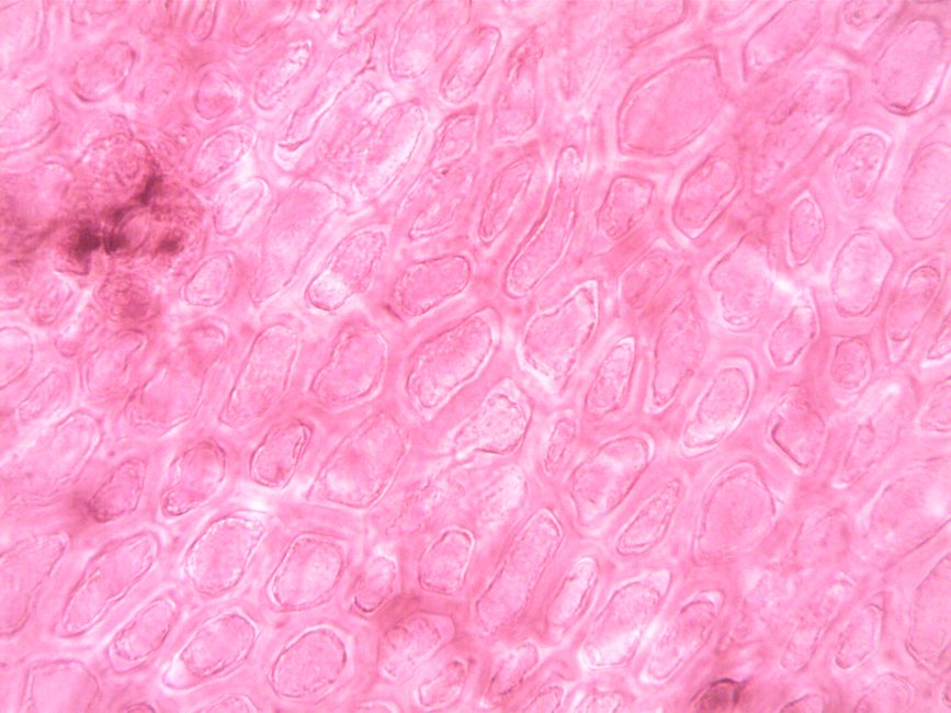 What Is Hematocrit in a Blood Test? The Number Dehydration Can Quietly - red blood cells microscope