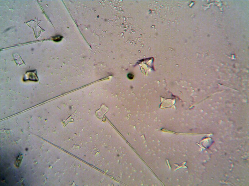 What Is a Low RDW Blood Test? Why Lower Is Usually Good News - red blood cells microscope