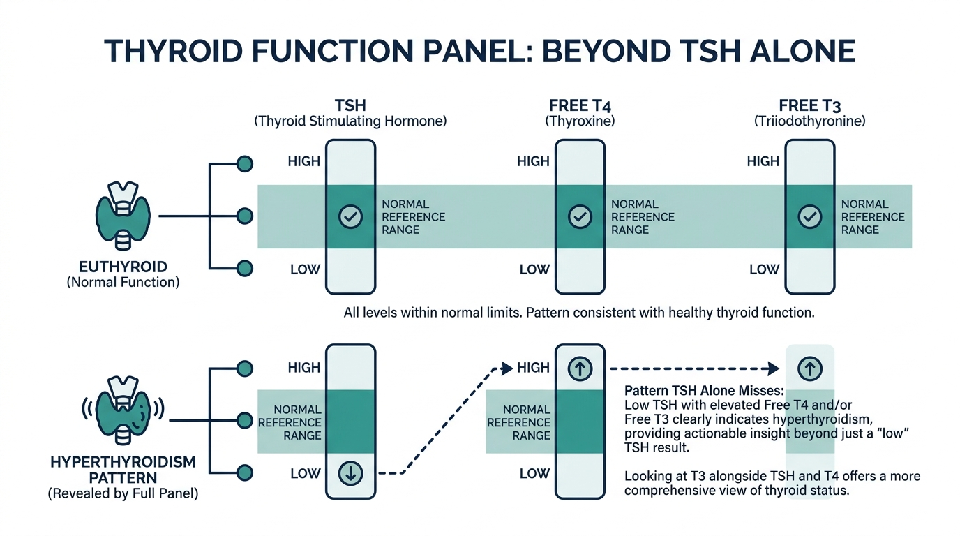 Schematic chart comparing TSH, free T4, and free T3 reference bands side by side