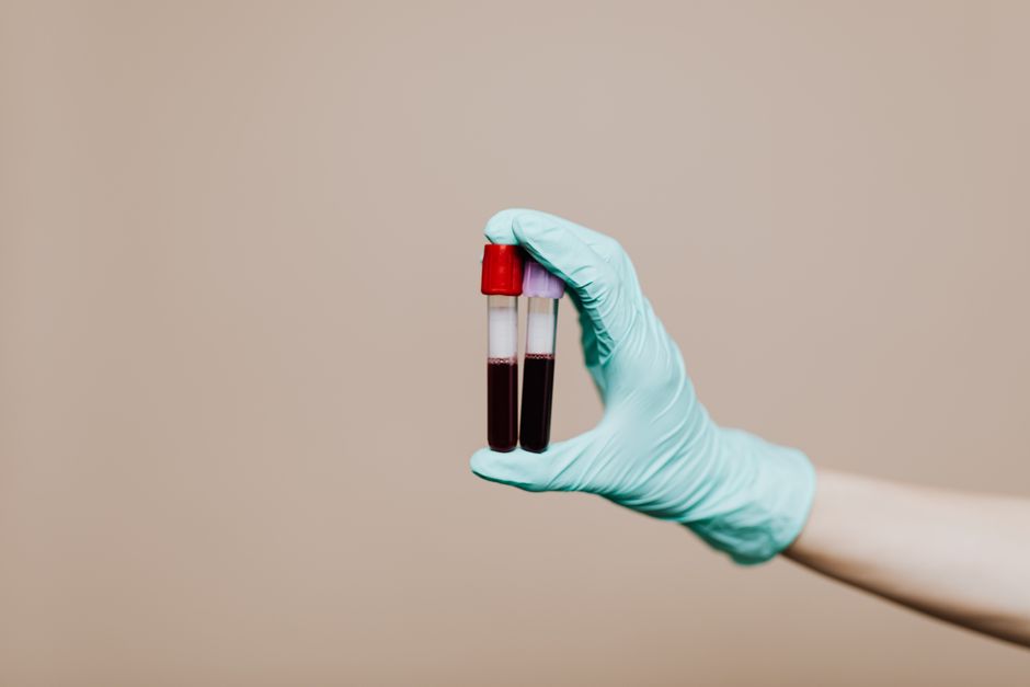 How Long to Fast Before a Blood Test: The Hours That Actually Matter - test tubes blood samples