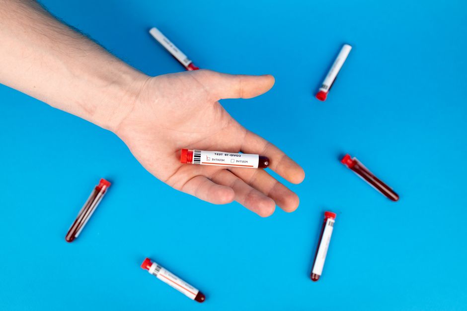 What Is an LDH Blood Test? The Sensitive Marker That Flags Tissue Dama - test tubes blood samples