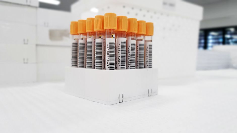 What Blood Test Shows Low Magnesium? Cutoffs, Causes, and What to Do - test tubes blood samples