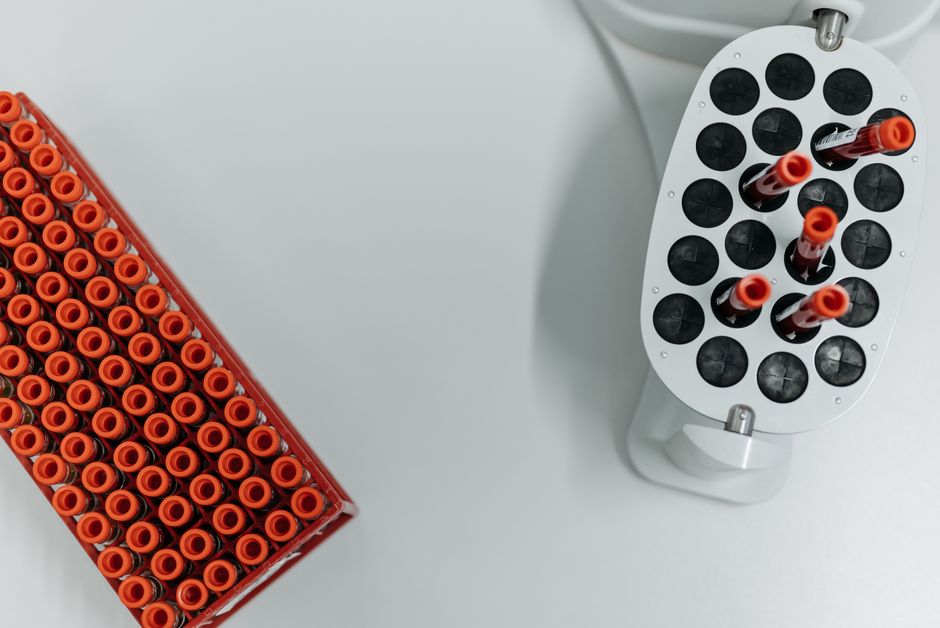 What Does High Bilirubin in a Blood Test Mean? Causes and When to Worr - test tubes blood samples