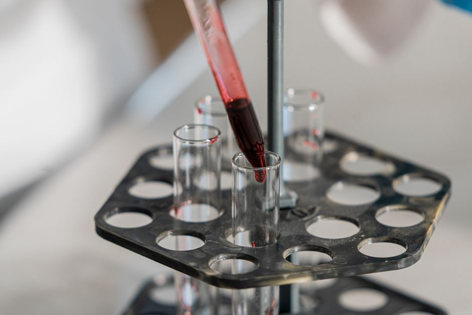 What Are High Lymphocytes in a Blood Test? What a High Count Really Me - test tubes blood samples