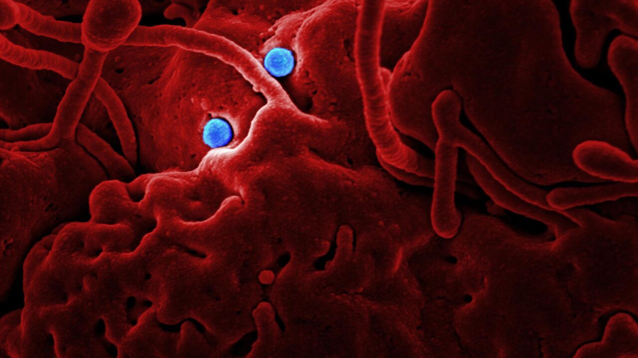 What Blood Test Shows Anemia? The CBC, Hemoglobin, and the Tests That Find the Cause