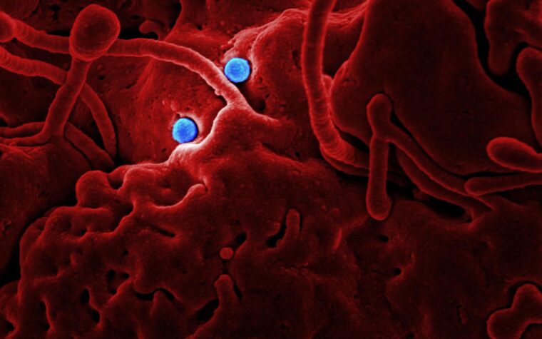 What Blood Test Shows Anemia? The CBC, Hemoglobin, and the Tests That Find the Cause