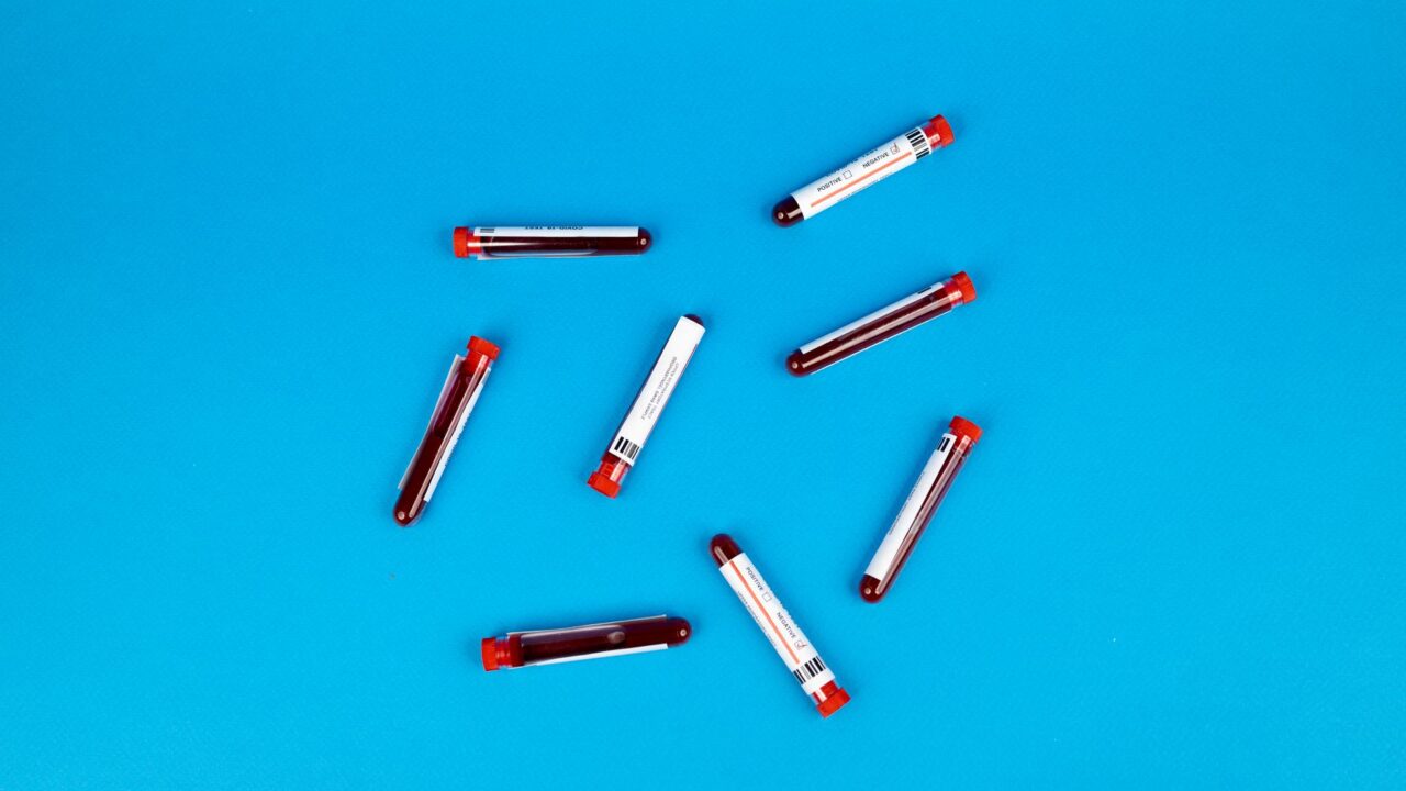 What Do They Test For in Routine Bloodwork?