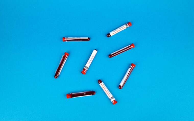 What Do They Test For in Routine Bloodwork?