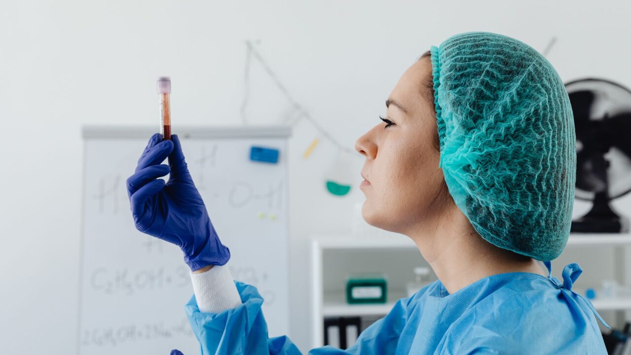 What Does a High CK Blood Test Mean? Causes, Thresholds, and Red Flags