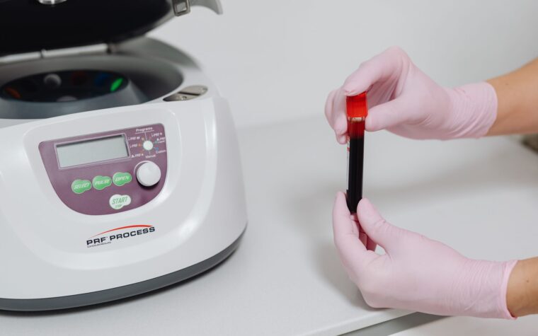 What Does a High INR Blood Test Mean? Cutoffs and Causes