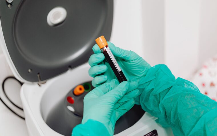 What Does a Low PLT Mean in a Blood Test? Low Platelet Count Explained