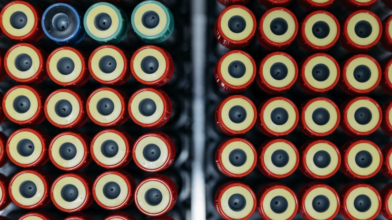 What Does High Eosinophils Mean in a Blood Test? Causes, Cutoffs, and Red Flags