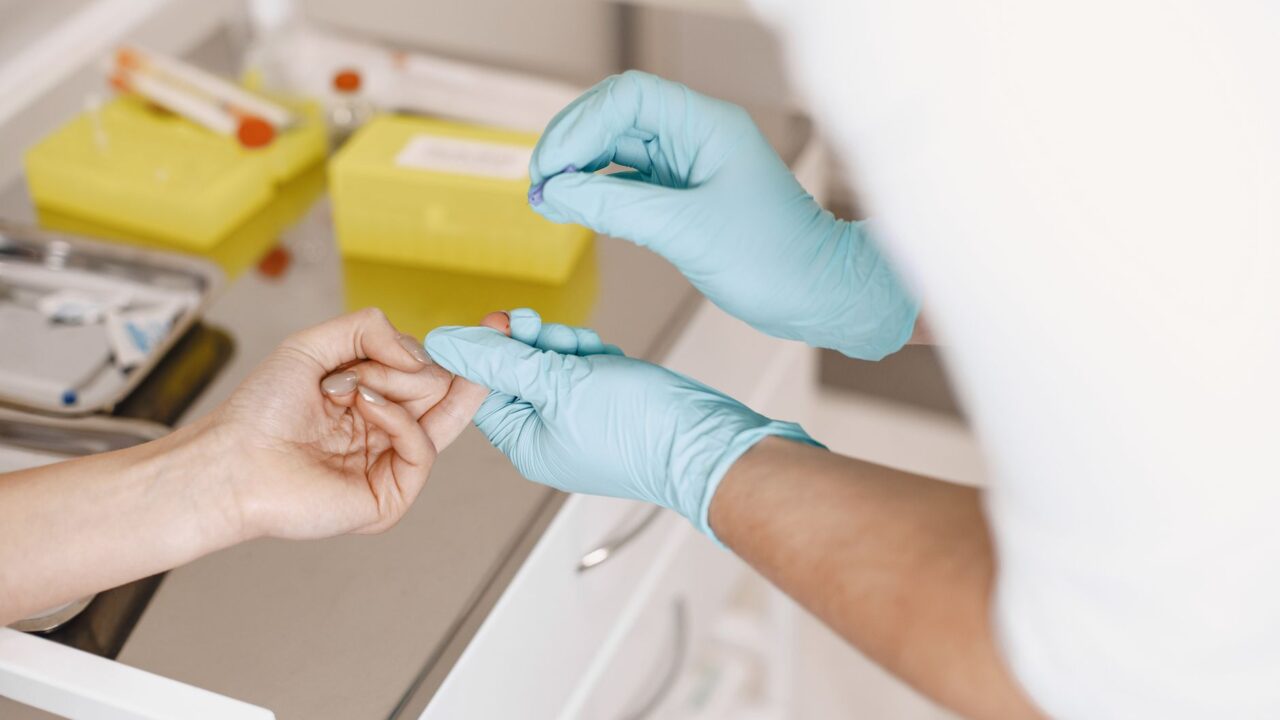 What Does High Monocytes in a Blood Test Mean? Causes and When to Worry