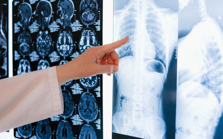 What Does Low Bilirubin Mean in a Blood Test? Causes and Risks