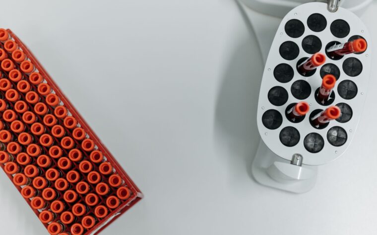 What Does Low CK Mean in a Blood Test?