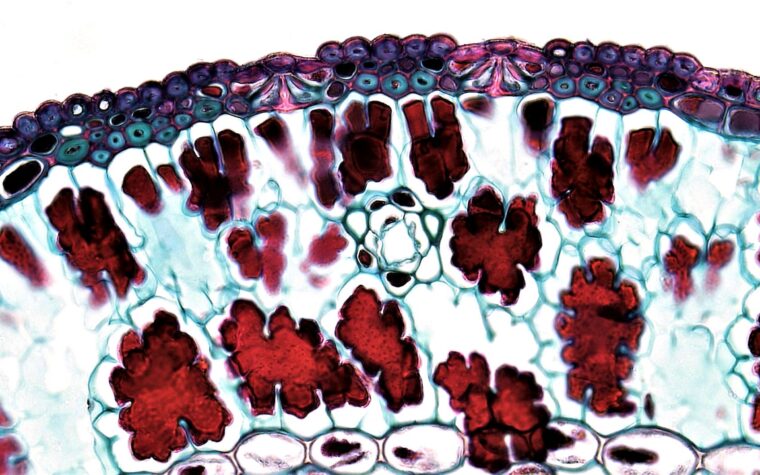 What Does Low Hemoglobin Mean in a Blood Test? Causes, Symptoms, and When to Worry
