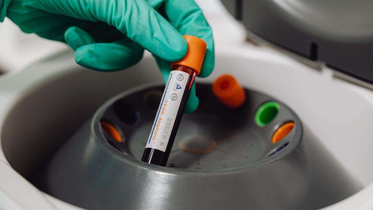 What Does Low INR Mean in a Blood Test?
