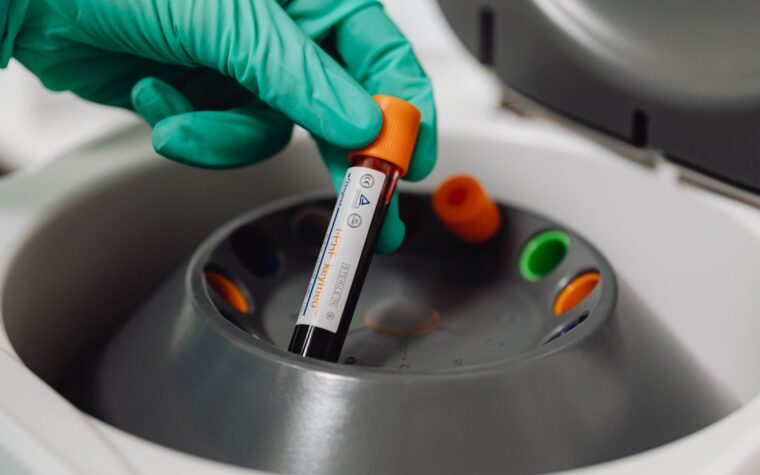 What Does Low INR Mean in a Blood Test?