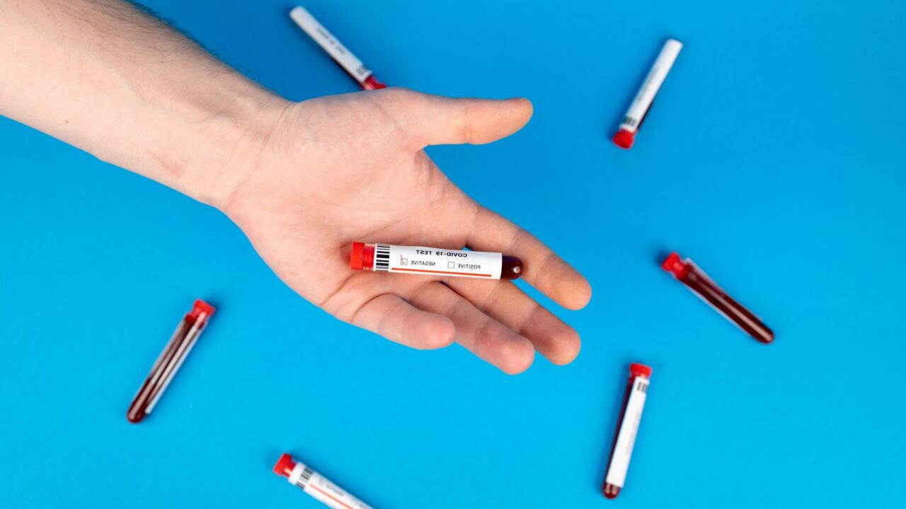 What Does Low Lymphocytes Mean in a Blood Test? Causes and When to Worry