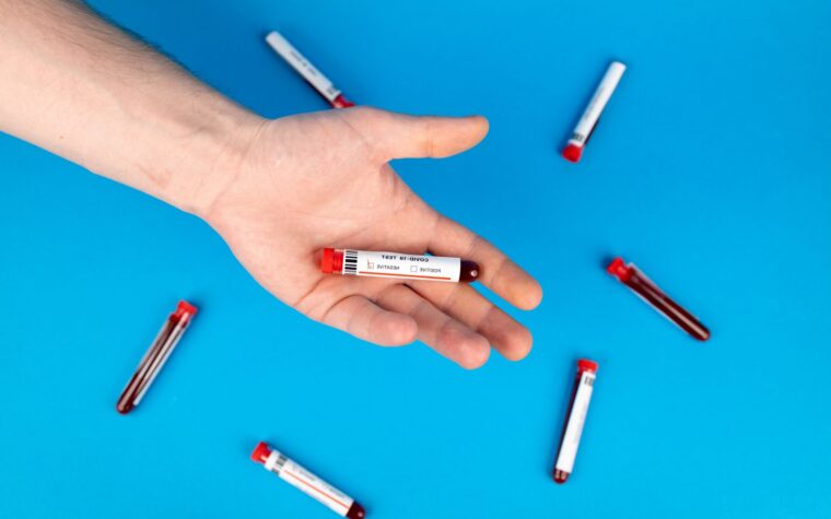 What Does Low Lymphocytes Mean in a Blood Test? Causes and When to Worry