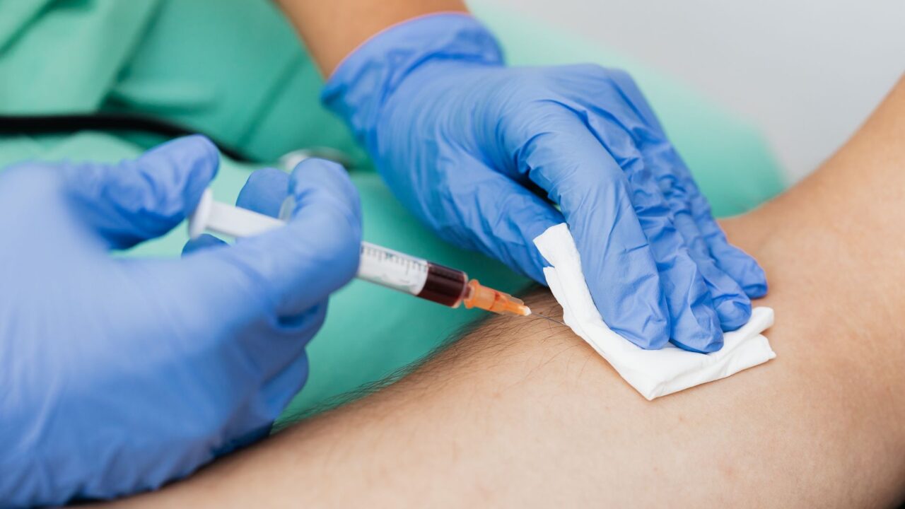 What Does Low Monocytes in a Blood Test Mean? Causes and When to Worry
