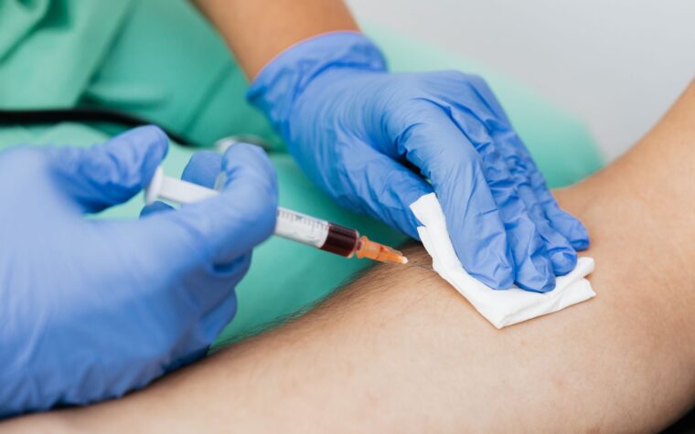 What Does Low Monocytes in a Blood Test Mean? Causes and When to Worry