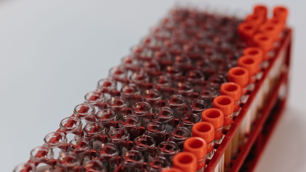 What Does Low Triglycerides Mean in a Blood Test?