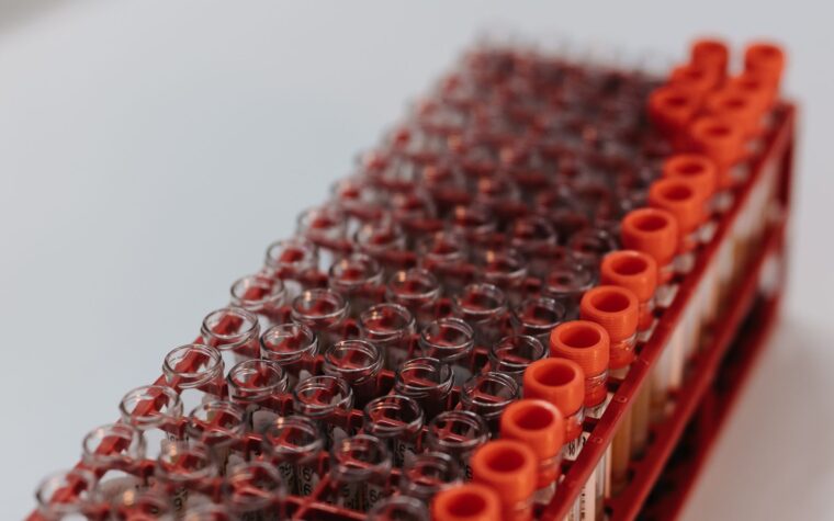 What Does Low Triglycerides Mean in a Blood Test?