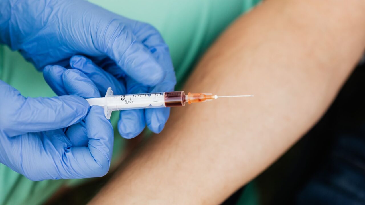 What Is a CMP Blood Test? The 14-Point Metabolism Check You Have Never Read