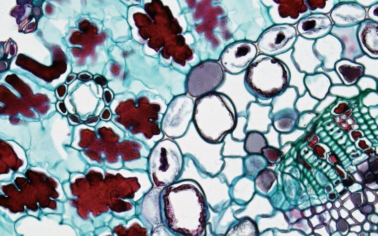 What Is a High MCH in a Blood Test? Causes, Risks, and Next Steps