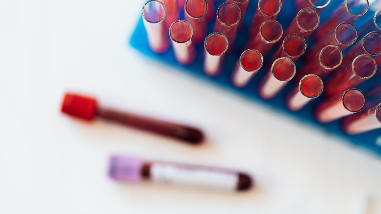 What Is a High MPV Blood Test? What an Elevated Result Really Means