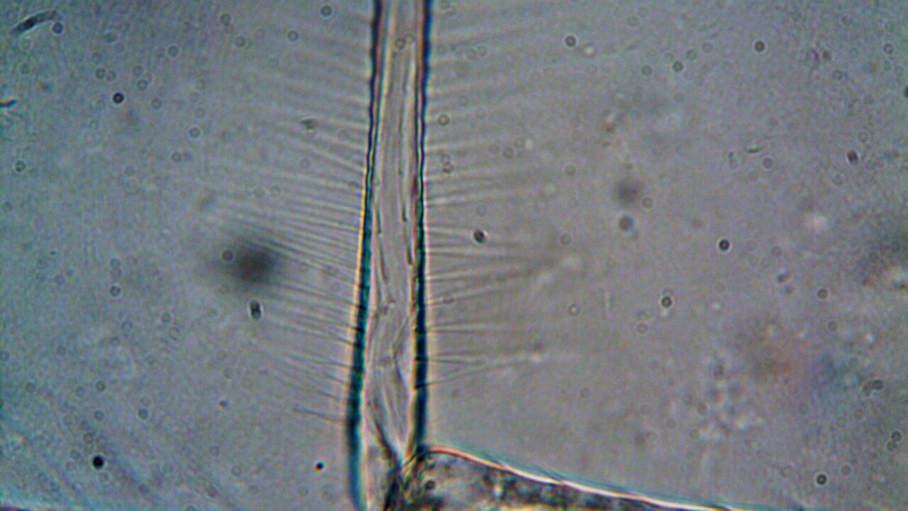 What Is a High RBC Blood Test? What an Elevated Red Blood Cell Count Means