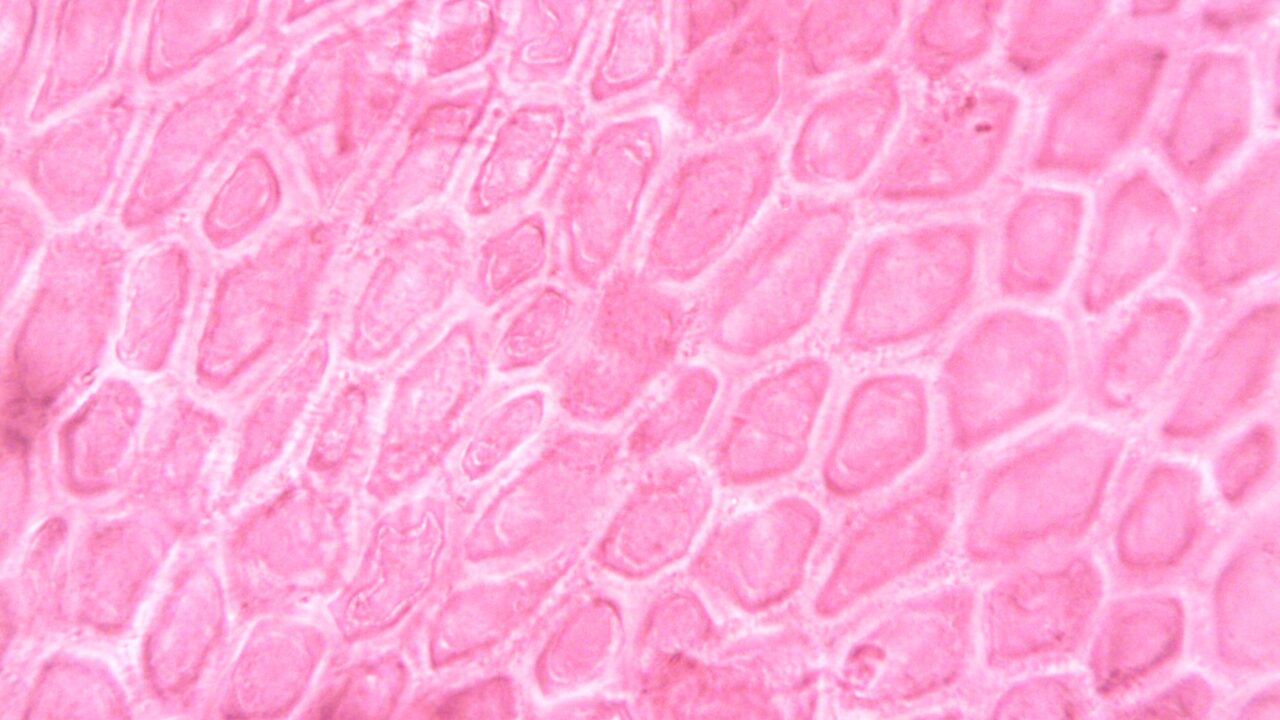 What Is a High RDW in a Blood Test? Causes and When to Worry