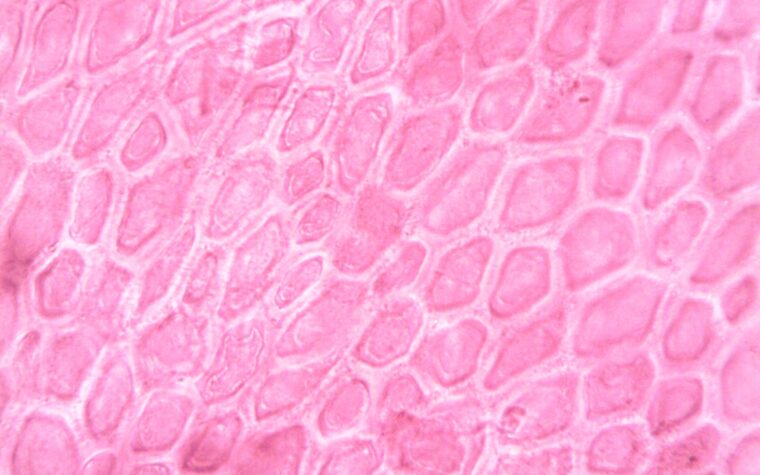 What Is a High RDW in a Blood Test? Causes and When to Worry