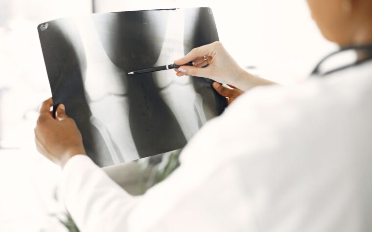 What Is Alkaline Phosphatase in a Blood Test? The Liver vs Bone Clue Most People Misread