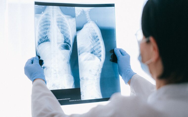 What Is AST and ALT in a Blood Test? The Two Liver Numbers and the Gap Between Them
