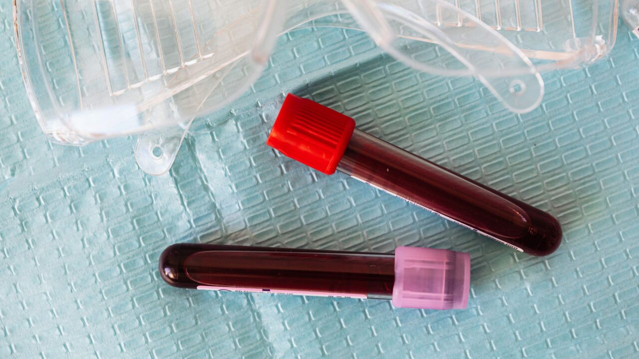 What Is Eosinophils in a Blood Test? The Allergy Cell That Reveals More Than You Think
